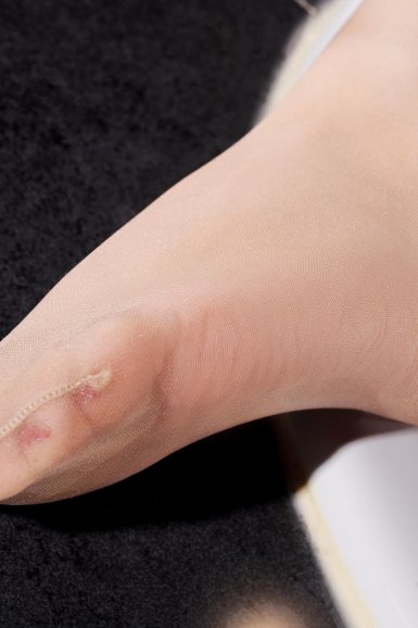 【半岛体育网站】我国核桃产业目前存在的问题(图4) 半岛体育网站